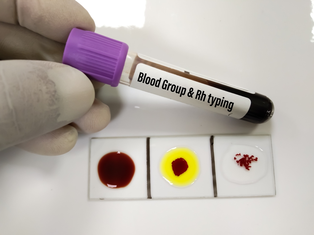 hematología